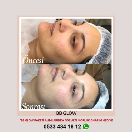 Gözde Şenkal | Güzellik Uzmanı | Kalıcı Makyaj Uygulamaları