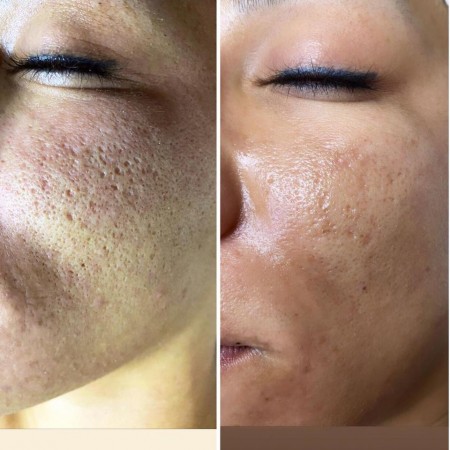 Gözde Şenkal | Güzellik Uzmanı | Kalıcı Makyaj Uygulamaları