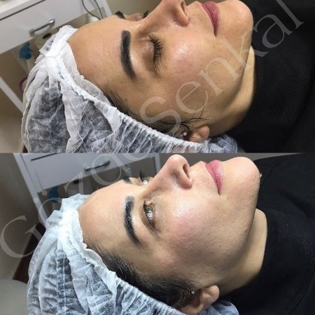 Gözde Şenkal | Güzellik Uzmanı | Kalıcı Makyaj Uygulamaları